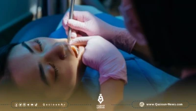 نحو 800 طبيب أسنان غادروا دمشق