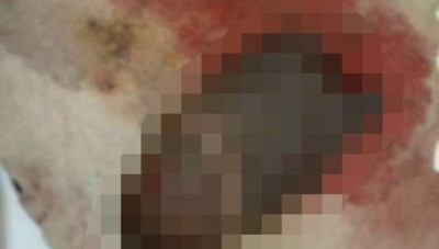 بسبب غيرتها...امرأة تفقد زوجها رجولته إلى الأبد  