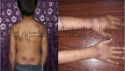 عذّبه حتى الموت ...شاب يحرق أخاه بالتعاون مع والدته في البوكمال