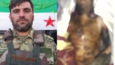 قسد تحرق مقاتل من الجيش الوطني