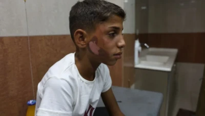 تعرض طفل للتعذيب في حماة وتوقيف المتورط